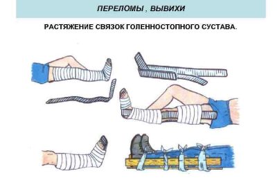 Как отличить ушиб от серьезных травм?