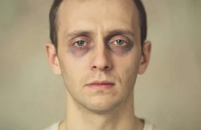 К чему приводит дефицит железа?