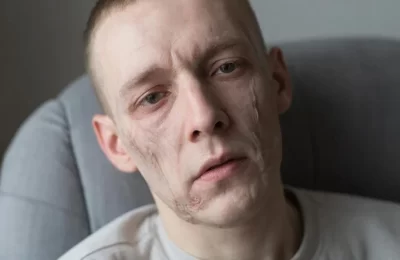 Что нужно знать о гипотиреозе